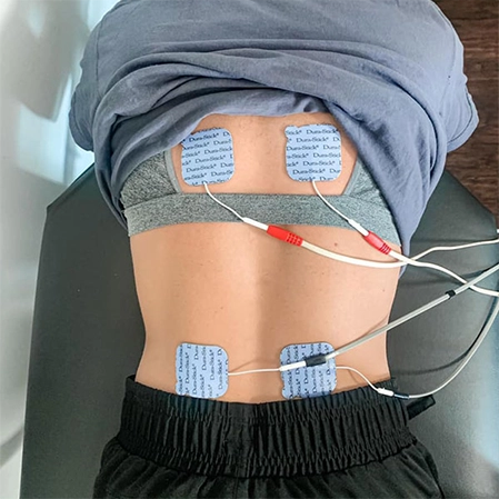 Patient With Electric Muscle Stimulation Electrodes On Back